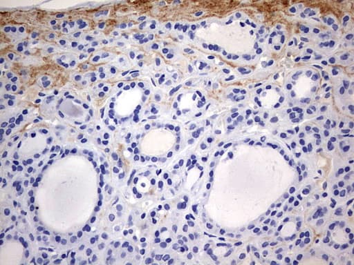 RIPK3 / RIP3 Antibody (aa233-518, clone OTI1B3)