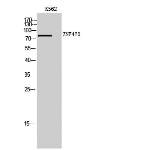 Polyclonal Rabbit anti-Human ZNF420 Antibody (270-350 aa, Internal, WB)