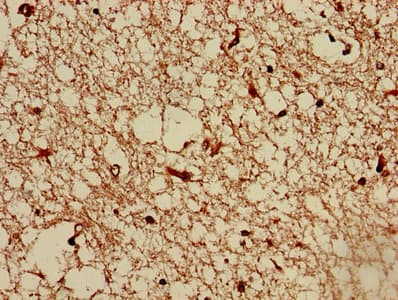 TMEM161B Antibody