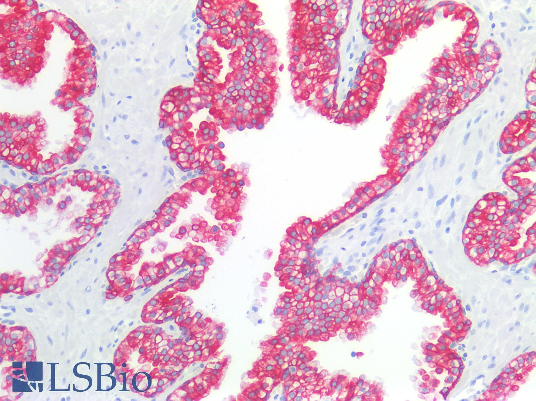 PathPlus™ Monoclonal Mouse anti-Human KRT19 / CK19 / Cytokeratin 19 Antibody (clone BA-17, IHC, WB)