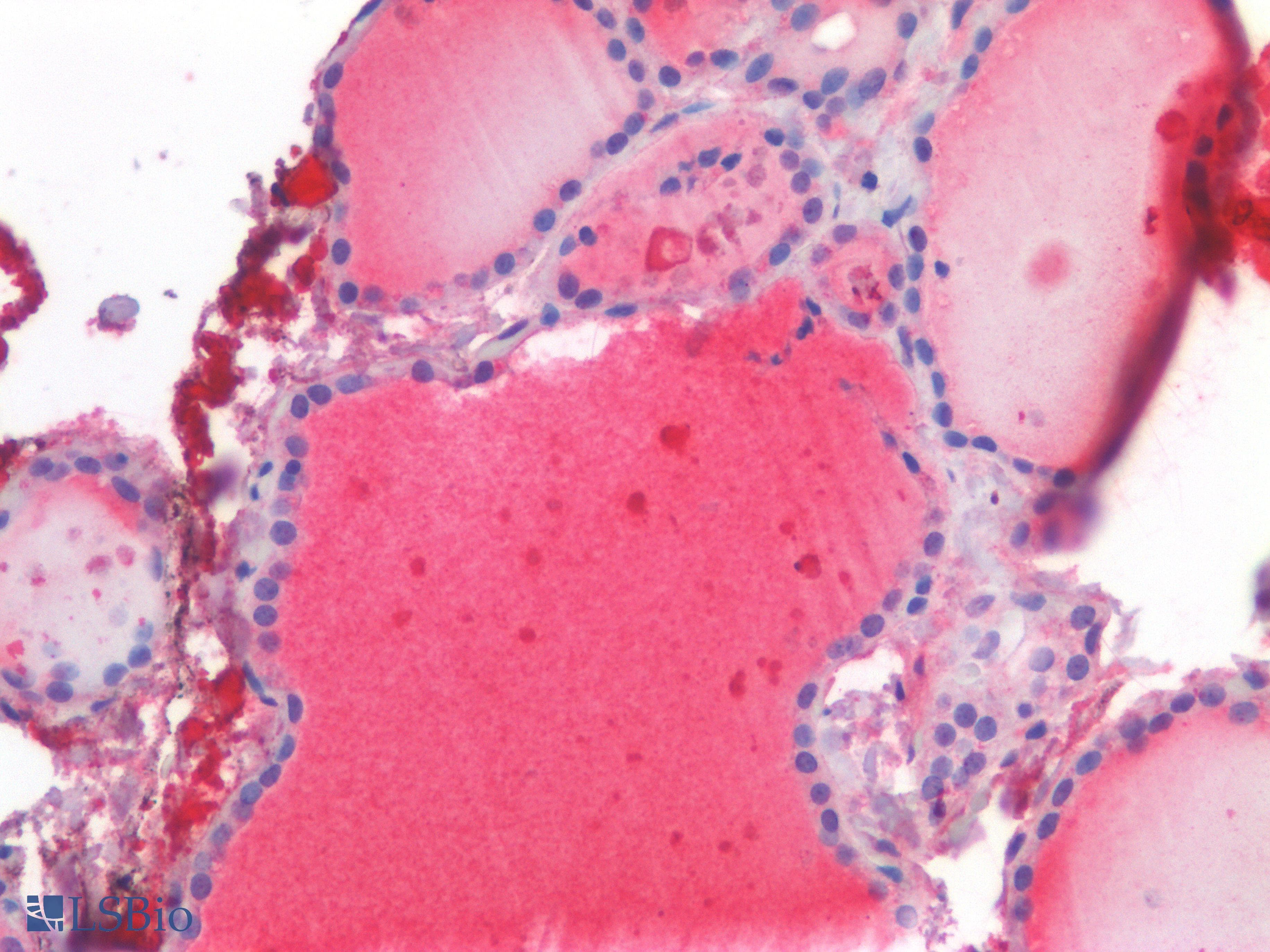 IHC-plus™ GPX3 Antibody