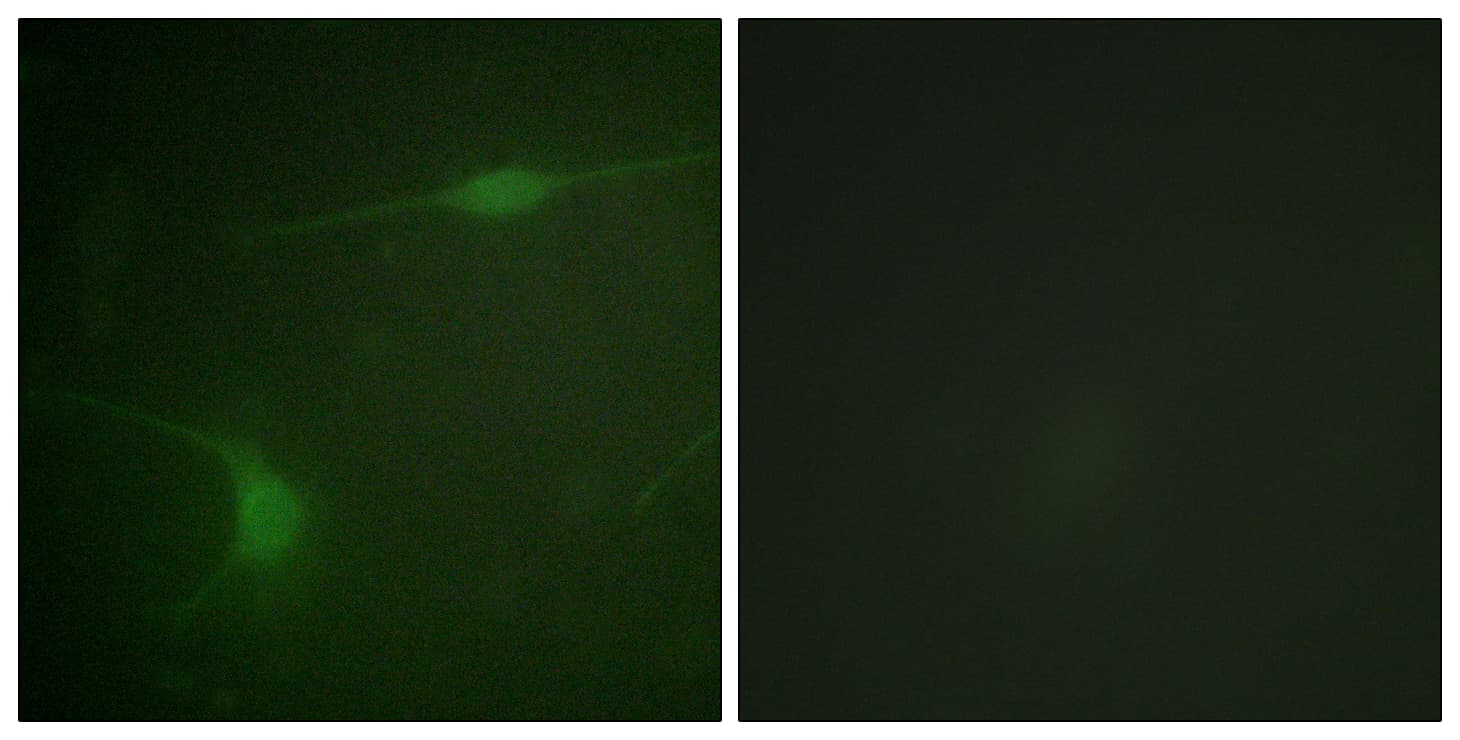 Polyclonal Rabbit anti-Human MAPK8IP1 / JIP1 Antibody (phospho-Thr103, IF, WB)