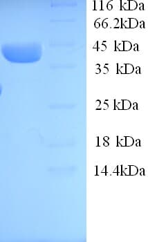 Human ELAVL3 / HUC Protein (Recombinant 6His, N-terminus)