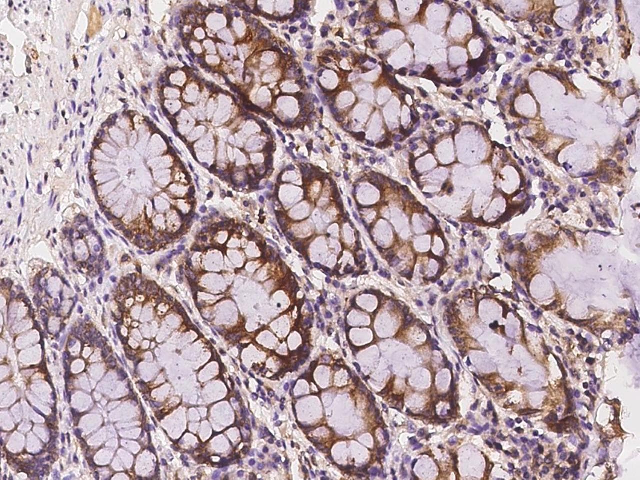Polyclonal Rabbit anti-Human PWP2H / PWP2 Antibody (IHC, IF)