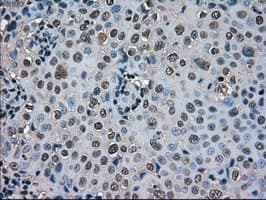 SOD1 / Cu-Zn SOD Antibody (clone 8B10, Carrier-free)
