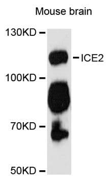 ICE2 / NARG2 Antibody