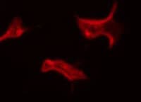 ITGA5/Integrin Alpha 5/CD49e Antibody