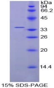 Chicken CCND1 / Cyclin D1 Protein (Recombinant His)