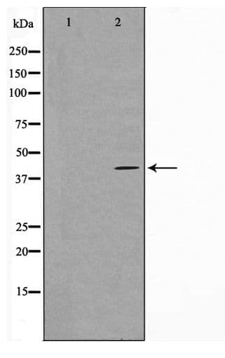 HTR5A / 5-HT5A Receptor Antibody