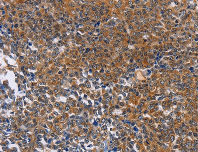 DPYSL4 / CRMP3 Antibody
