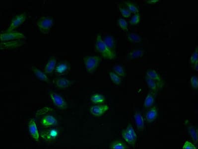 Polyclonal Rabbit anti-Human RAIG2 / GPRC5B Antibody