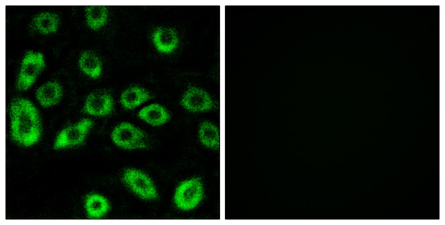 Polyclonal Rabbit anti-Human ATP5D Antibody (aa61-110, IHC, IF)