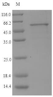 Porphyromonas gingivalis kgp Protein (Recombinant 6His-SUMO, N-terminus)