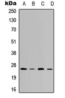Polyclonal Rabbit anti-Human VTI1B Antibody (Internal, WB)