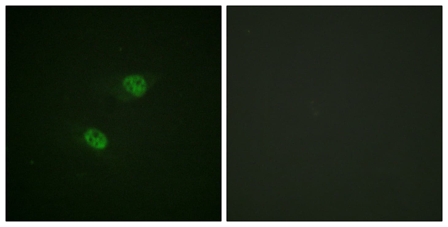APC6 / CDC16 Antibody (phospho-Ser560)