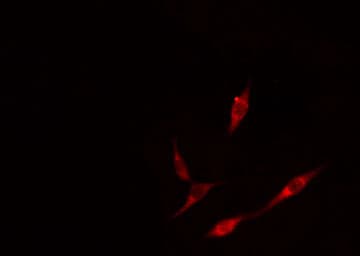 Polyclonal Rabbit anti-Human PML Antibody (IHC, IF, WB)