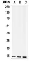 CD52 Antibody (N-Terminus)