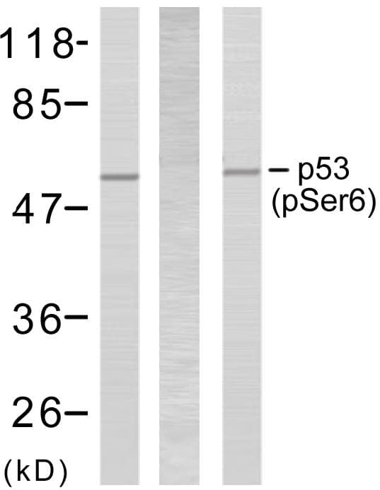 TP53 / p53 Antibody (phospho-Ser6)