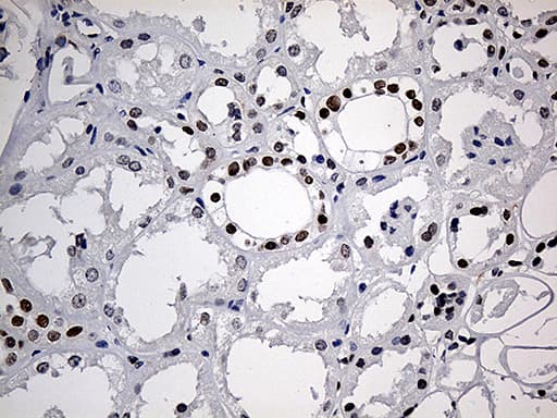 Monoclonal Mouse anti-Human MECP2 Antibody (clone OTI2F1, aa224-486, IHC, WB)