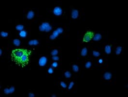 XPNPEP3 Antibody (clone OTI2D5)