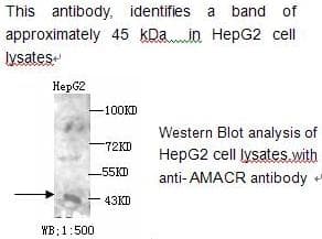 AMACR / P504S Antibody
