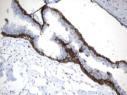 MME / CD10 Antibody (aa411-750, clone UMAB235)