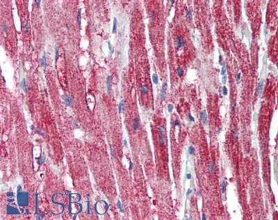 IHC-plus™ CKMT1B Antibody (aa63-287)
