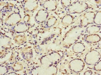 Polyclonal Rabbit anti-Human GBF1 Antibody (IHC, IF)