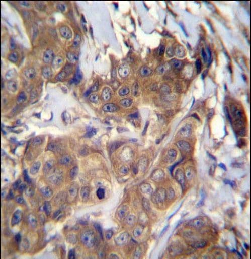 ATP6V1B1 Antibody (aa472-501)