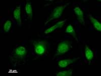 ISL2 / Islet 2 Antibody (clone 203C5a)