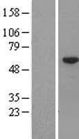 CFAP53 / CCDC11 Protein (Over-Expression Lysate Myc-DDK (Flag))