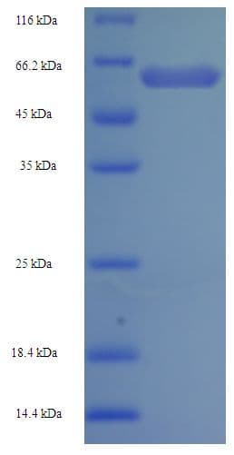 Human OGDH Protein (Recombinant His-SUMO)