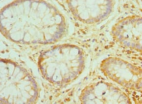 PRDX1 / Peroxiredoxin 1 Antibody (aa1-199)