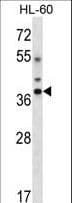 DLX5 Antibody (aa100-128)