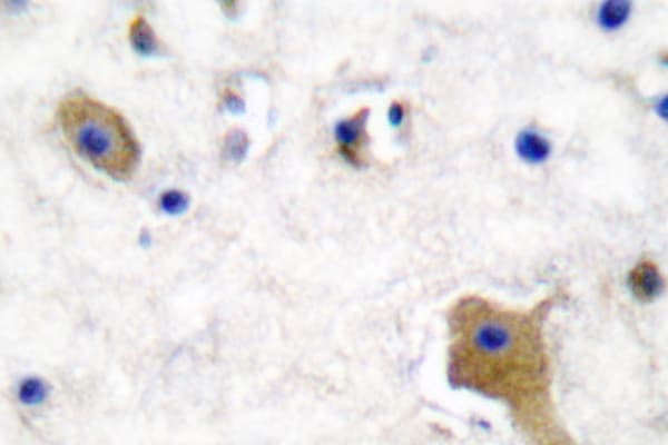 MAPT / Tau Antibody (phospho-Ser356)