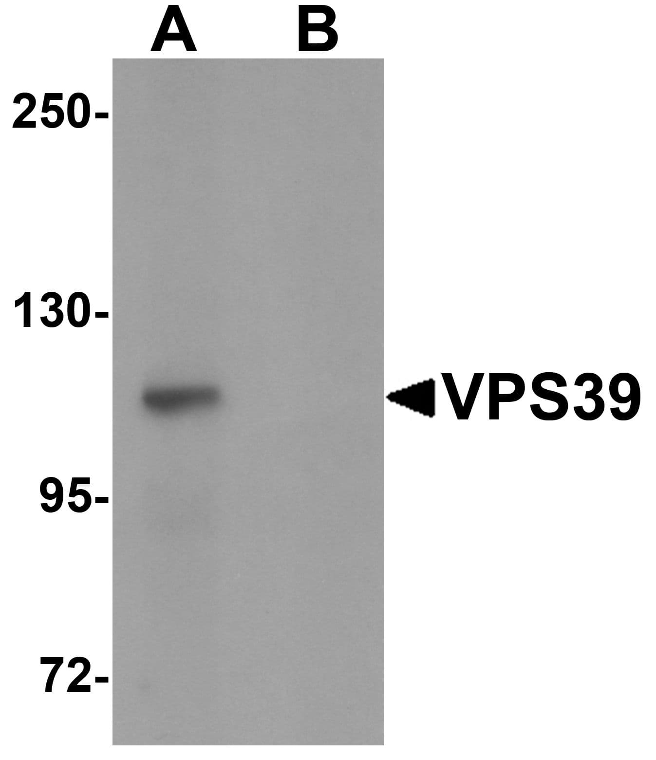 IHC-plus™ Polyclonal Rabbit anti-Human VPS39 Antibody (IHC, IF, WB)