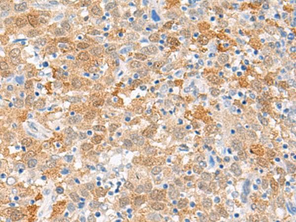 FANCB / FAB Antibody