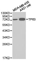 TP63 / p63 Antibody