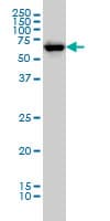 IHC-plus™ CHEK2 / CHK2 Antibody (clone 4B7)