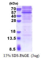 Human RAPSN Protein (Recombinant His)