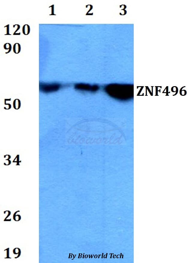 ZNF496 / NZIP1 Antibody