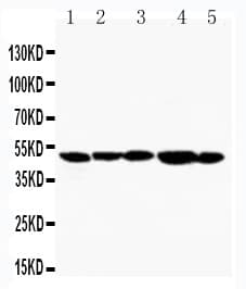 HAVCR1 / KIM-1 Antibody (aa289-307)