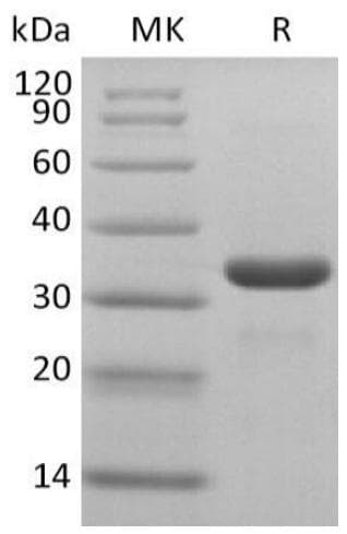 Coronavirus SARS-CoV-2 3C-like Proteinase (Recombinant 6His, N-terminus)