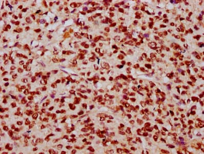 HIST1H2BN Antibody