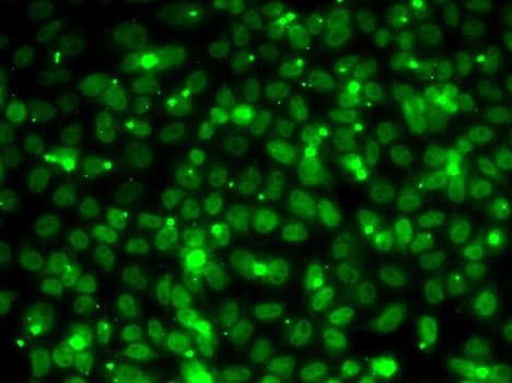 Polyclonal Rabbit anti-Human RPA3 Antibody (IF, WB)