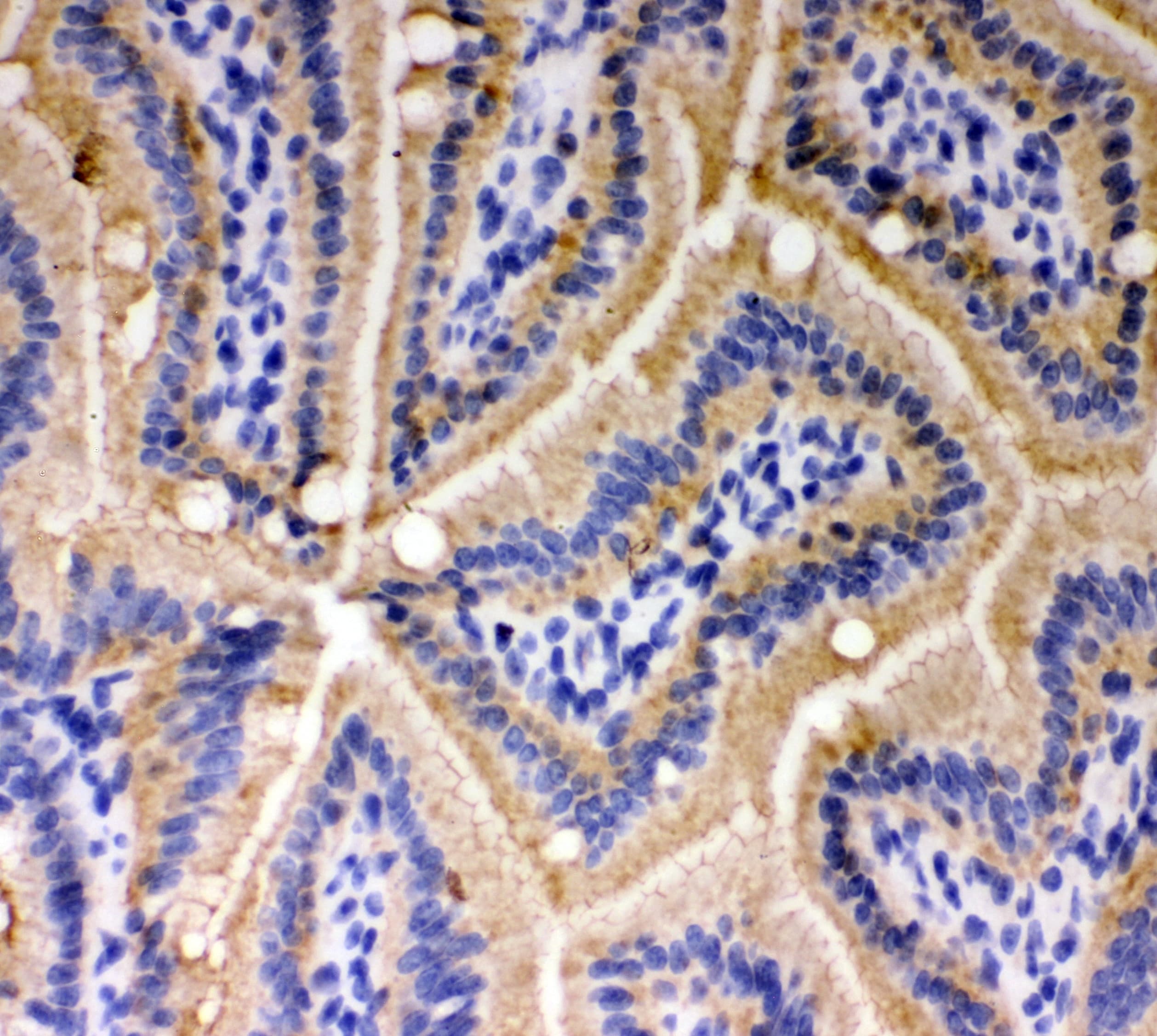 CDH1 / E Cadherin Antibody (aa286-703)