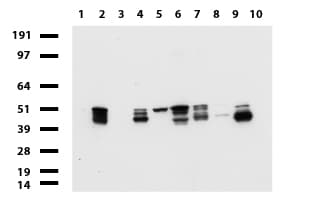 KRT18 / CK18 / Cytokeratin 18 Antibody (aa69-372, clone UMAB50)