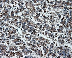 PLEK / Pleckstrin Antibody (clone OTI6H8)