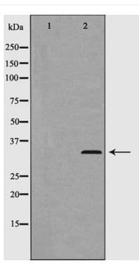 CCND2 / Cyclin D2 Antibody (phospho-Thr280)