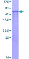 Human HOMER2 / Homer 2 Protein (Recombinant GST)